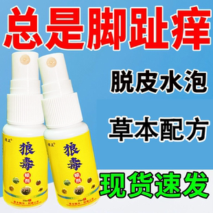 狼毒喷剂脚痒脚脱皮起小水泡烂脚丫脚臭脚汗脚痒足痒感染