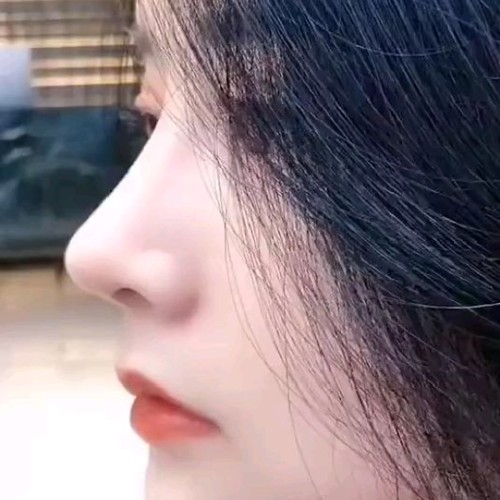 草本小翘鼻塑造精华 提拉紧致塑形挺翘美鼻改善塌鼻精油加强版