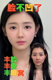 草本丰脸精华 改善凹陷丰眼窝丰鼻基底丰脸颊丰额头丰全脸天然