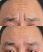 草本去川字纹 重度眉间川字纹皱纹紧致抗皱专用消除神器加强版