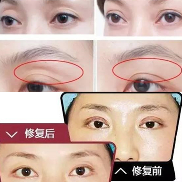 草本眼睑凹陷修復精油 改善眼袋紋路饱满眼周紧致弹力