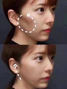 草本颧骨凹陷饱满精华 改善脸骨颧弓外扩突出精油加强版