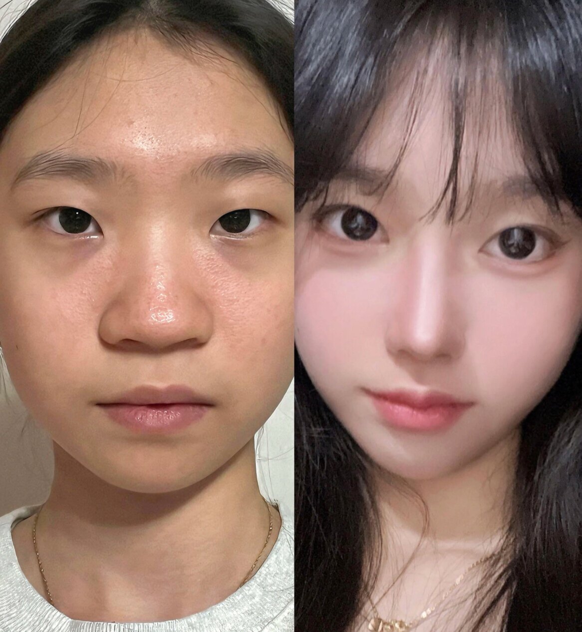 草本鼻头圆钝修复精华 缩小尖挺改善肥鼻宽鼻精致立体美鼻加强版