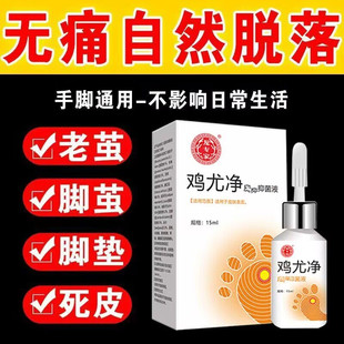 龙专家鸡尤净无痛去老茧脚垫瘊子足部手部成膜液小肉粒脚茧