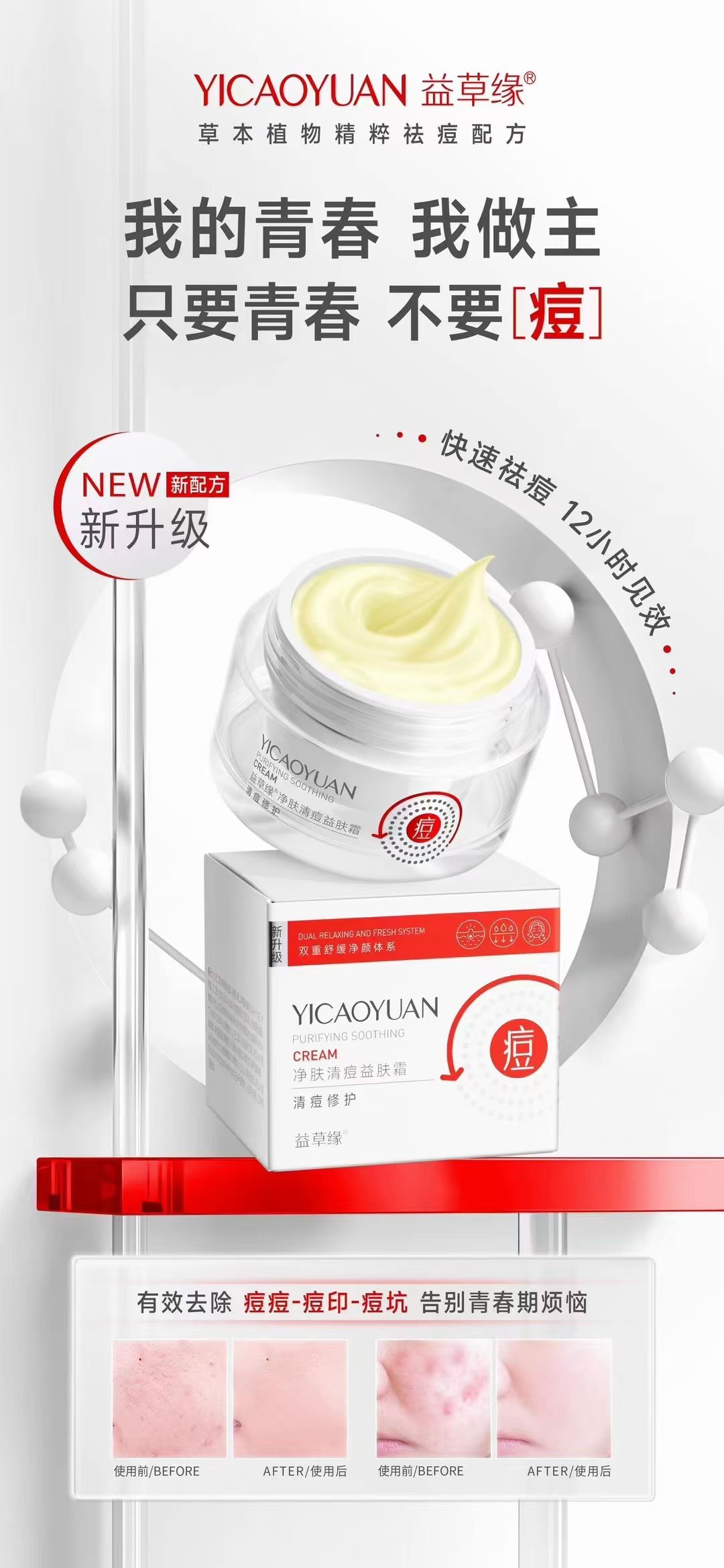 益草缘痘痘清修护四件组合控油保湿精华液益肤霜净肤祛痘淡印清爽