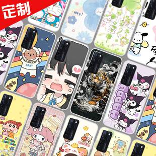 中兴AXON 20手机壳来图定制照片定做 ZTE A20保护壳 A2121手机套 卡通软胶图片DIY防摔
