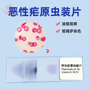 恶性疟原虫涂片吉姆萨染色厚薄血膜同片高教医学教学研究显微玻片