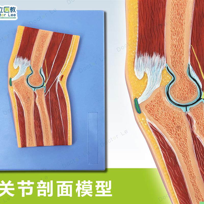 人体断层扫描 肘关节切面浮雕 手肘关节断层解剖学模型ct运动解剖
