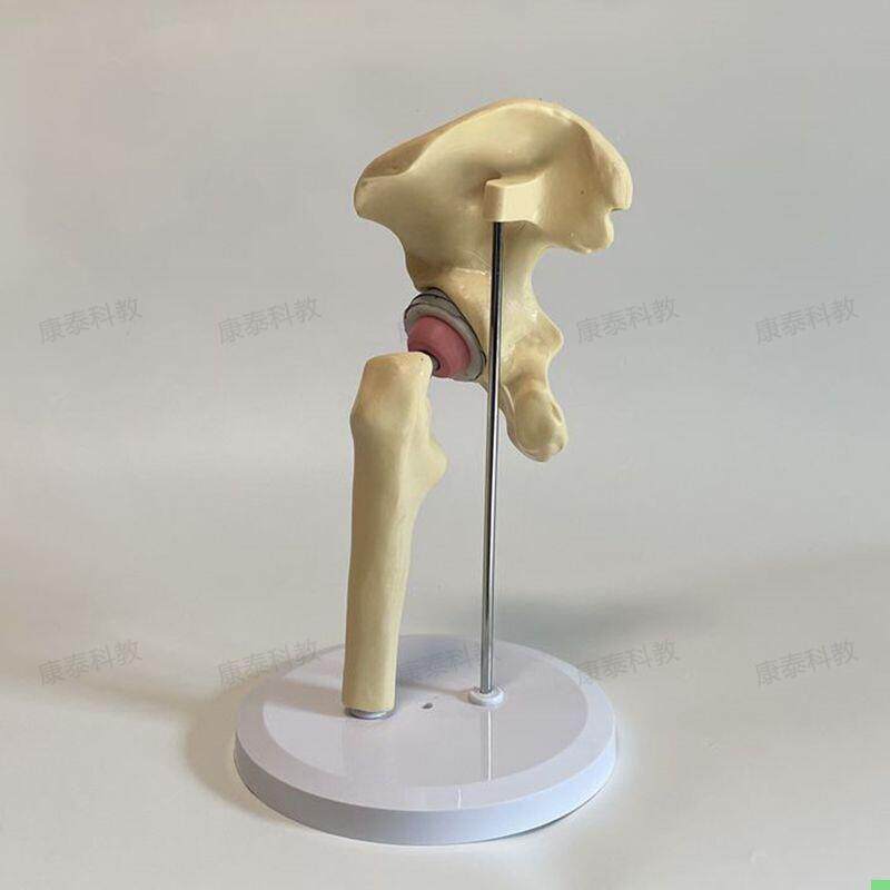 康泰教具人工髋关节置换模型假肢手术摆件医院髋臼假关节骨骼模型