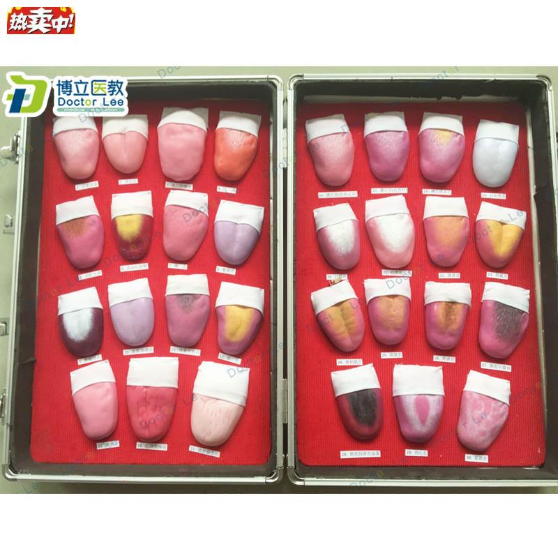 人体舌头舌苔常见病变比较模型口腔p护理医用教学人体模型