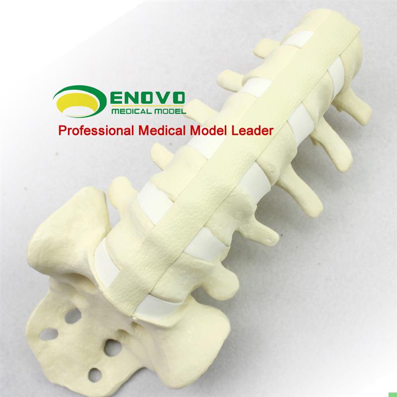 ENOVO颐诺人体 仿真腰椎尾骨模型 骨科手术前Sawbone人体腰椎钉棒