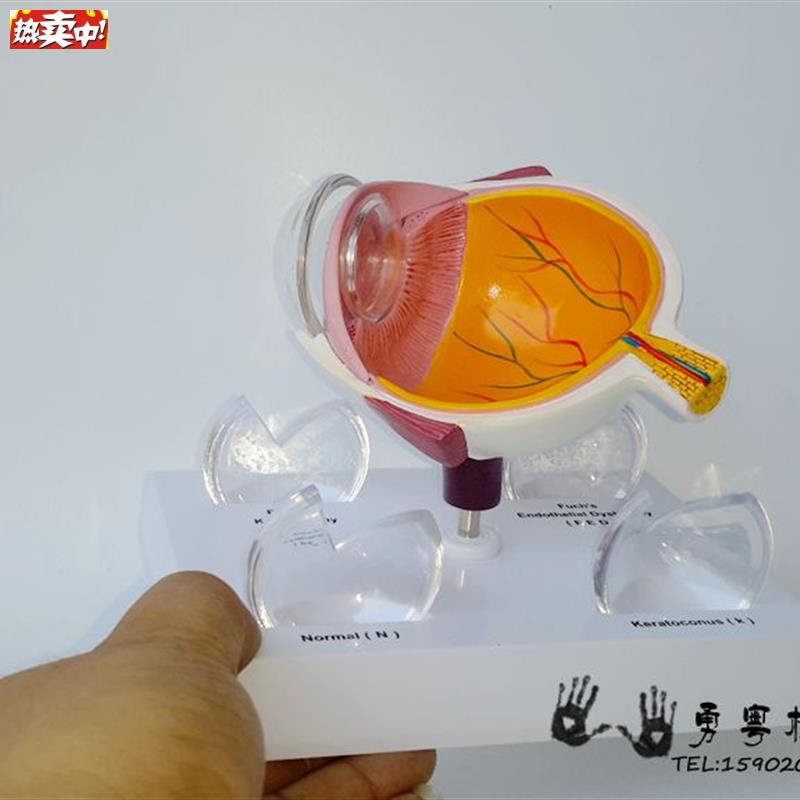 眼球疾病眼睛解剖眼球构造角膜疾病眼w球模型眼睛模型
