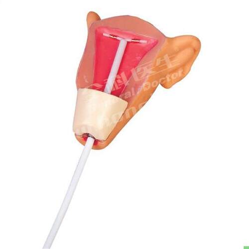 高级宫内避孕器训练模型GD/F9E