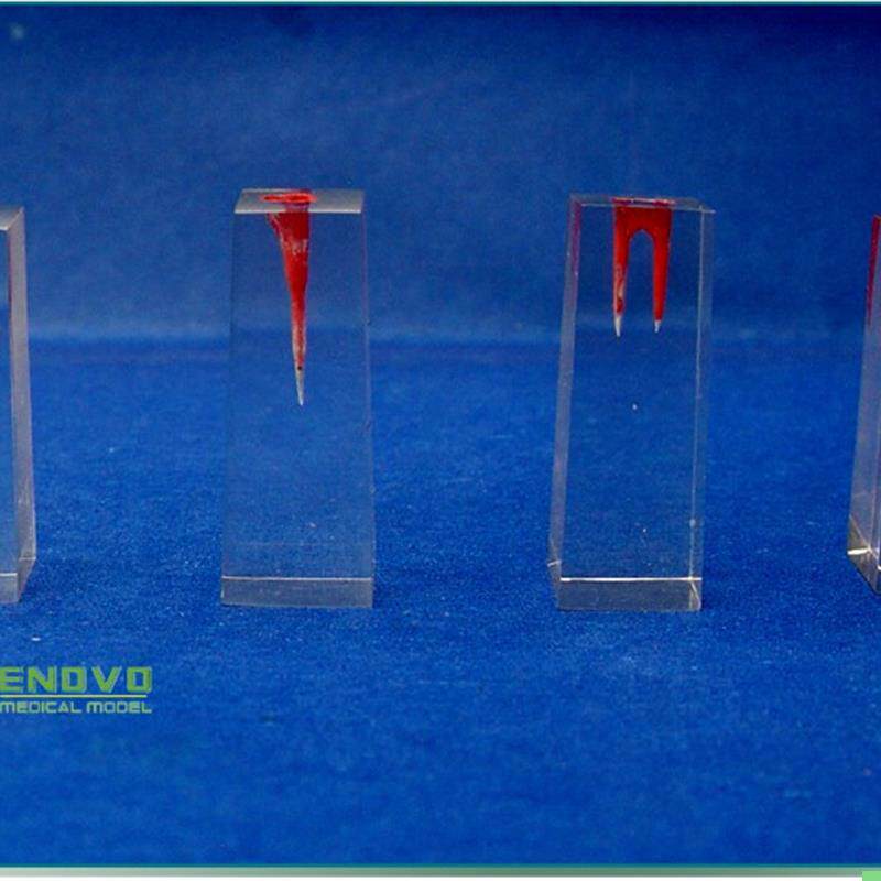 颐诺正品口腔科实习用根管模型牙体牙髓学根管充填和窝洞制备