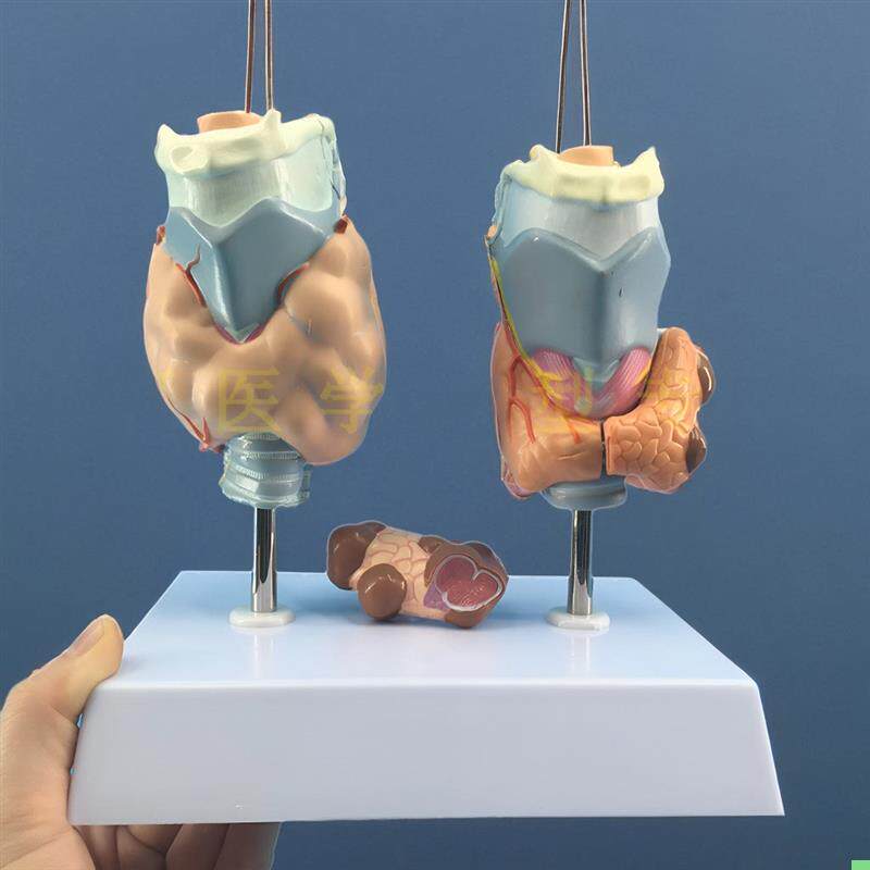 甲状腺病变 甲状腺病理模型 甲亢甲低甲减 人体内分泌系统模型