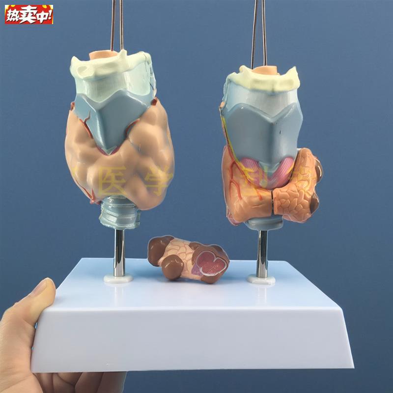 甲状腺病变甲状腺病理模型甲亢甲低甲Y减人体内分泌系统模型