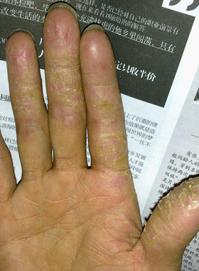 【抹不好白送】万人推荐10308【消不了分文不收】限时活动买2送1