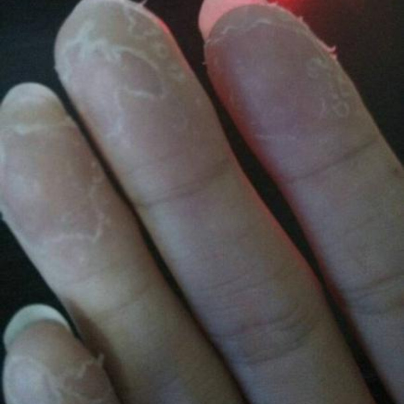 手指头开裂口子脱皮裂开干裂愈合膏护手霜手掌皲裂手脚底裂修复霜