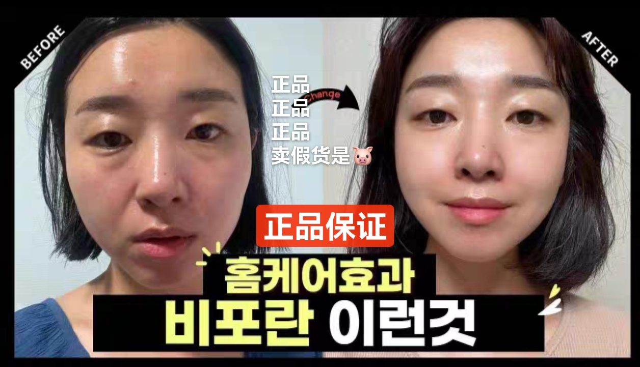 韩国轻医美面霜【击退法令纹嘴角纹】针对面部衰老  多效合一