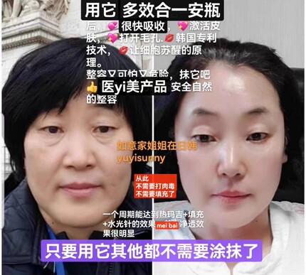 [整容又可怕 又危险 用它堪比整容]超声刀升级版韩国新技术 直邮