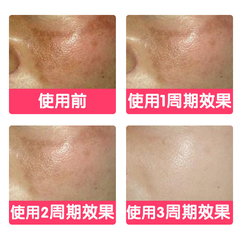 【清晨家】八味珍品透润去黄面膜 滋润补水亮肤收毛孔修护面膜泥