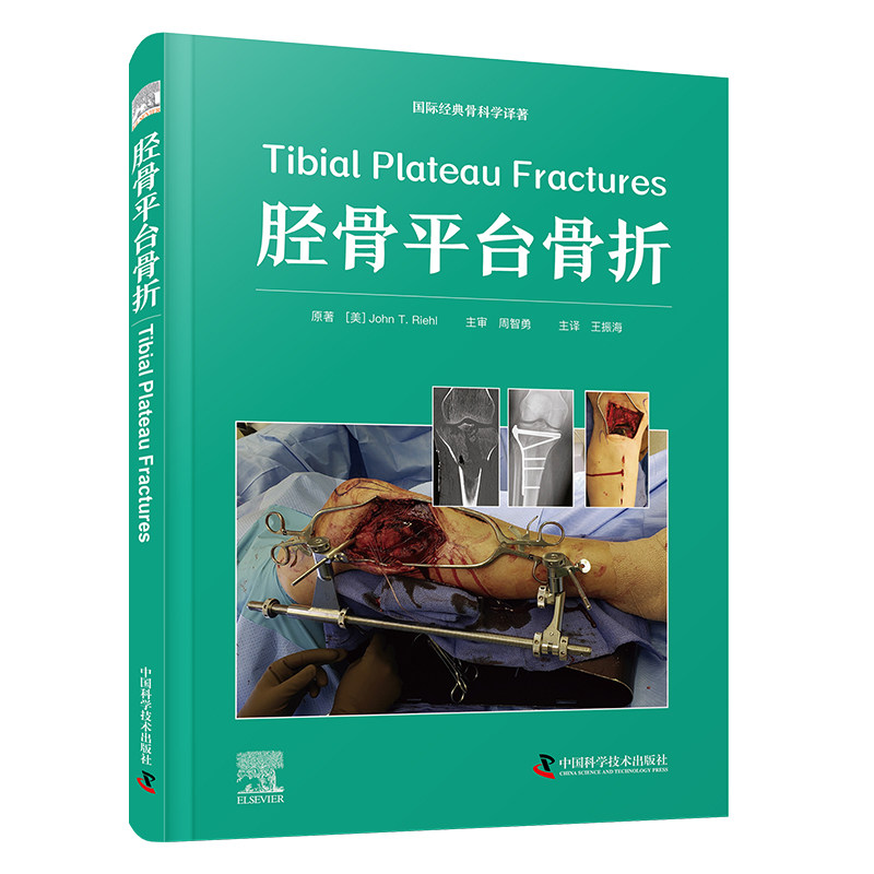 正版 国际经典骨科学译著：Tibial Plateau Fractures胫骨平台骨折（精装） 9787523606667 中国科学技术