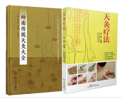 共2本岭南传统天灸大全+天灸疗法(第2版)针灸推拿医学书籍书