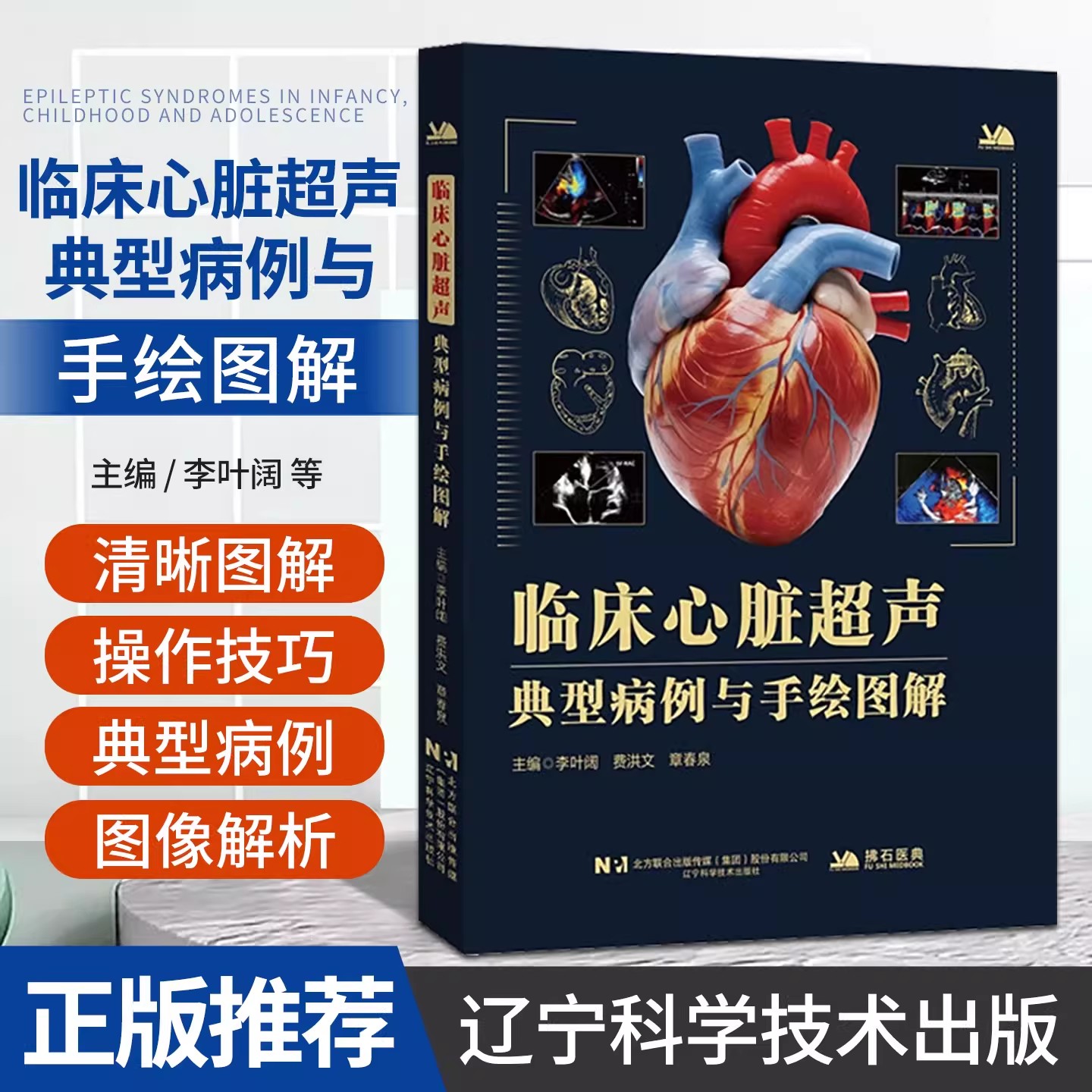 临床心脏超声典型病例与手绘图解 李叶阔 费洪文 章春泉主编 超声科医师技师心胸外科临床医生 辽宁科学技术出版社9787559145659