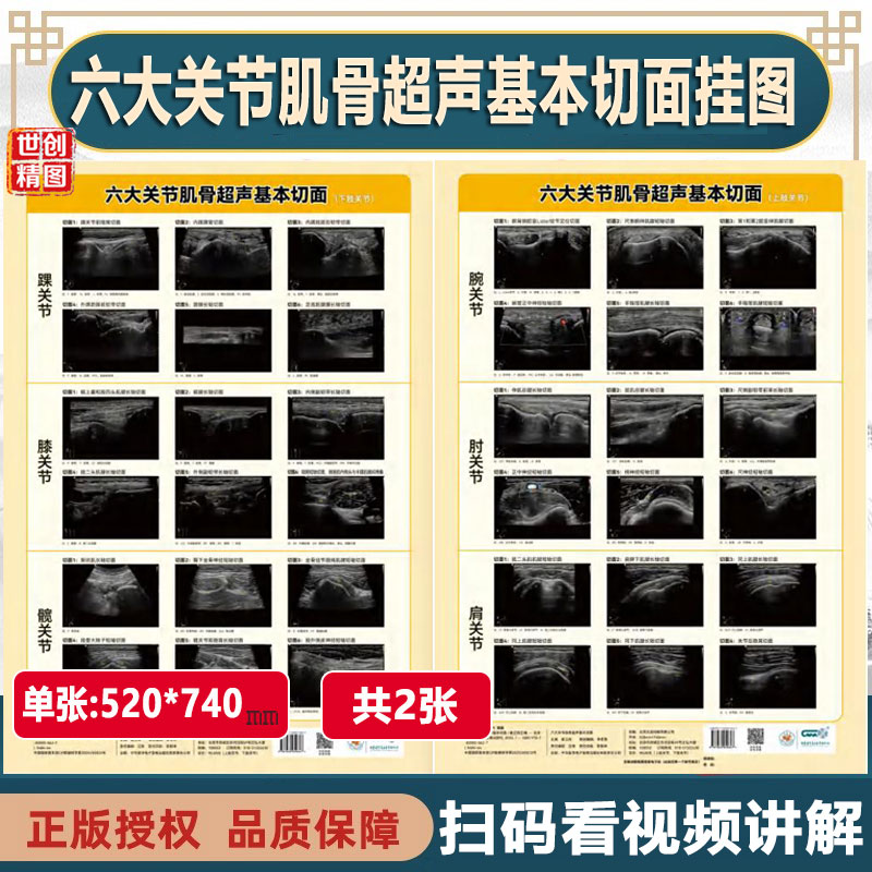 六大关节肌骨超声基本切面挂图 上肢关节腕关节 肘关节 肩关节 下肢关节踝关节 膝关节 髋关节挂图 超声实操视频彩超B超影像诊断图