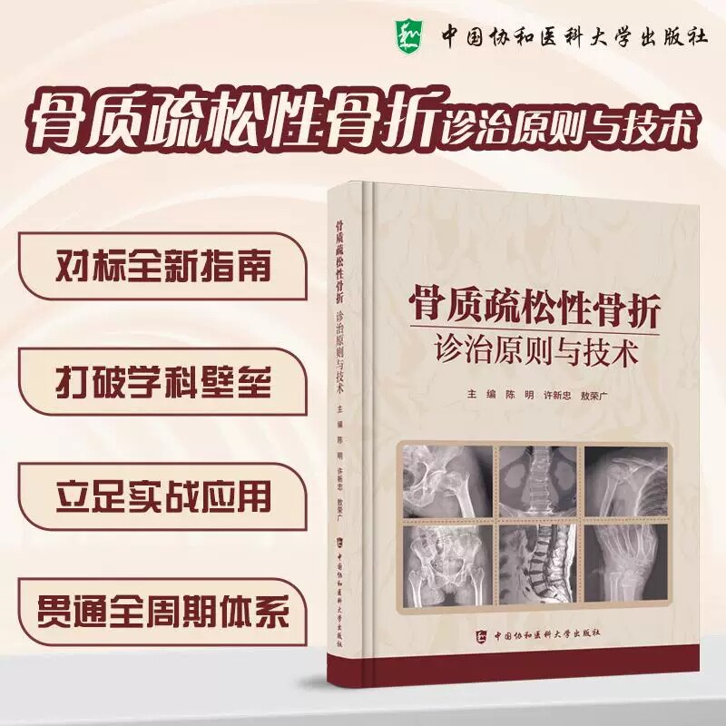 骨质疏松性骨折诊治原则与技术 陈明 许新忠 敖荣广 主编 对标全新指南 打破学科壁垒 9787567929128 中国协和医科大学出版社