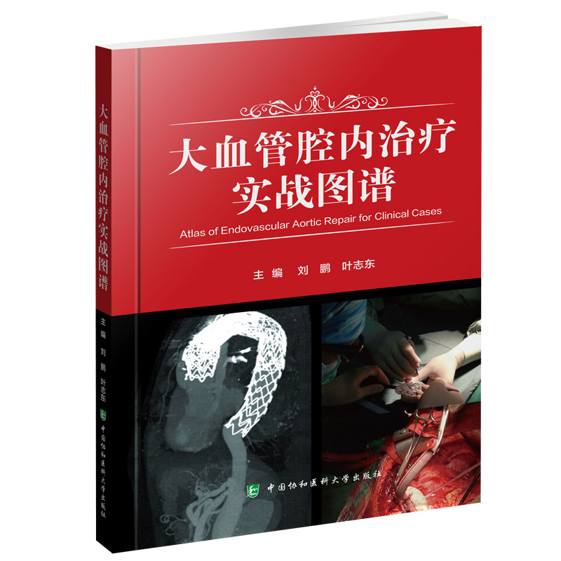 大血管腔内治疗实战图谱 刘鹏 叶志东 主编 中国协和医科大学出版社9787567917521医学书籍书