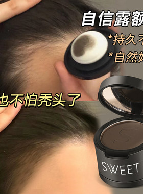 大方自信露额头再也不怕秃头了