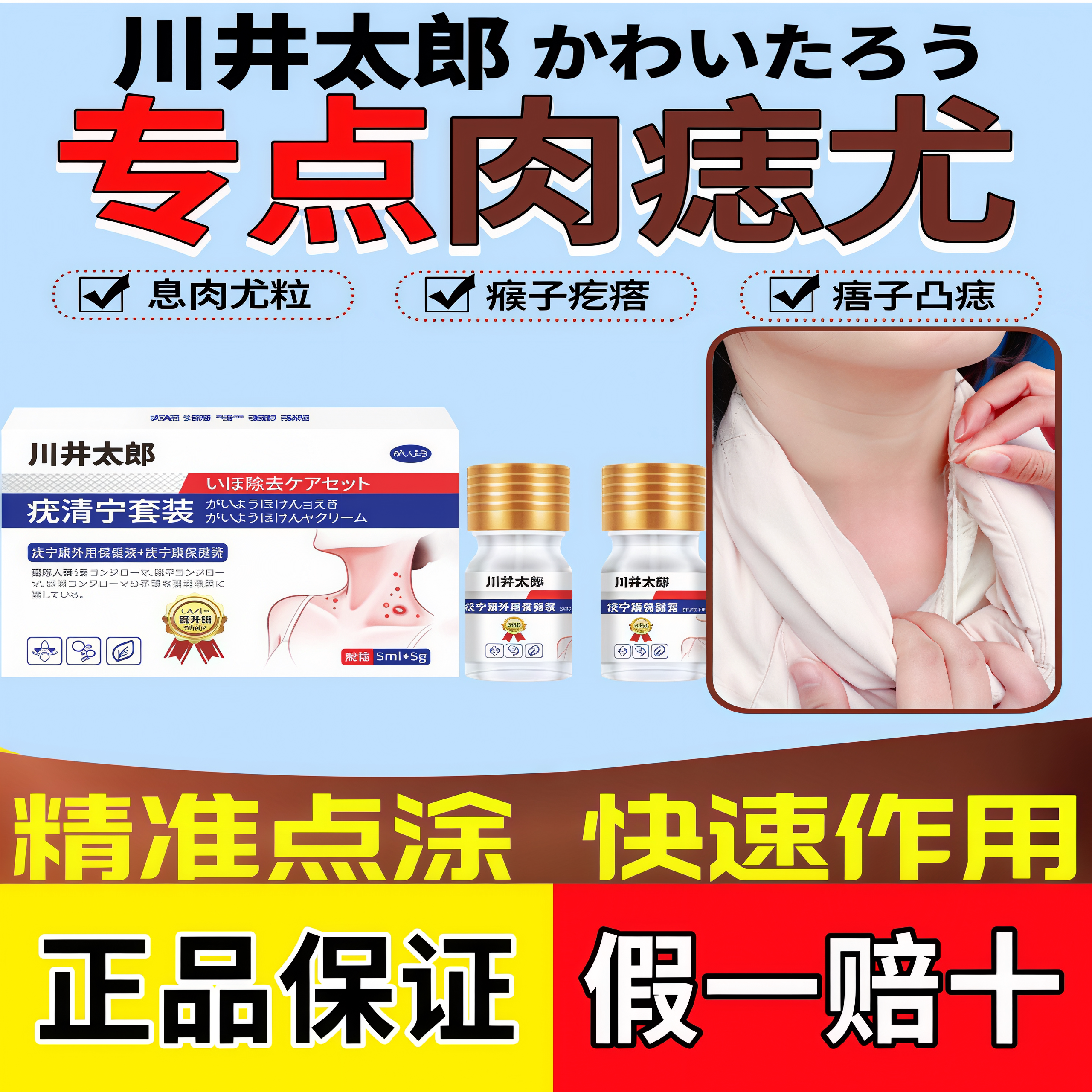 川井太郎疣清宁套装肉痣尤猴肉粒疙瘩皮肤外用抑菌膏正品图片