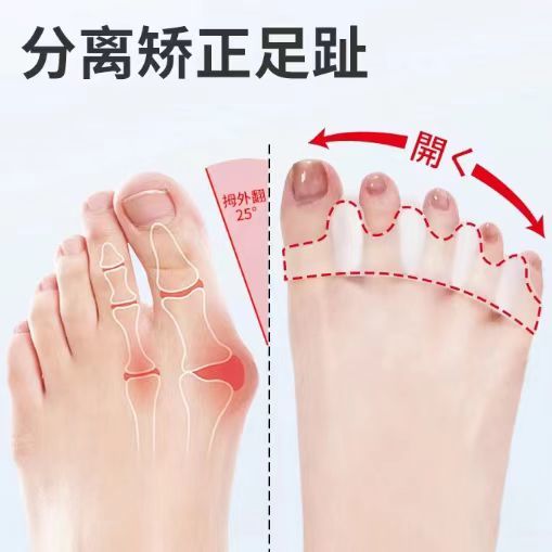 二脚趾弯曲矫正器锤状趾纠正器防磨隐形分趾分离器趾头抓地可穿鞋