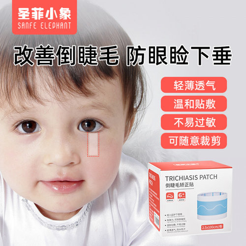 倒睫毛矫正贴儿童幼儿下眼睑眼皮