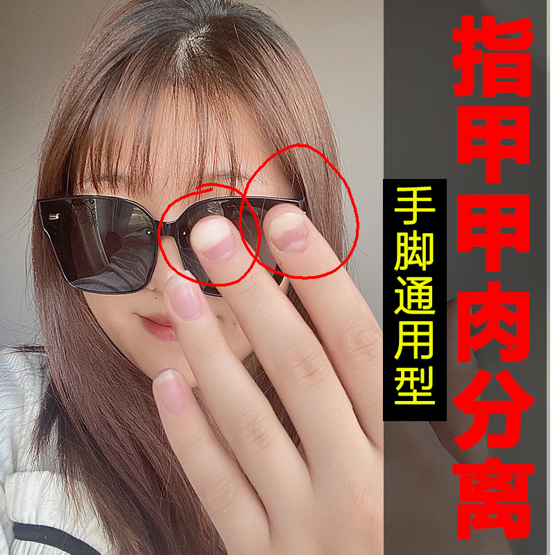 空甲分离修复甲剥离症手指甲空甲肉脚趾甲变空壳心营养不良亮甲油