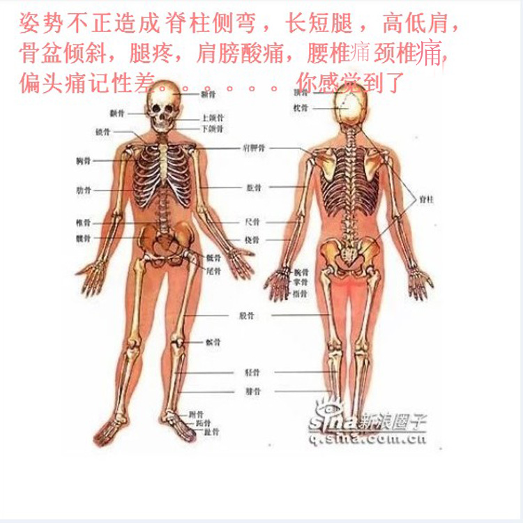 体衡骨盆脊柱侧弯长短腿背纠正器