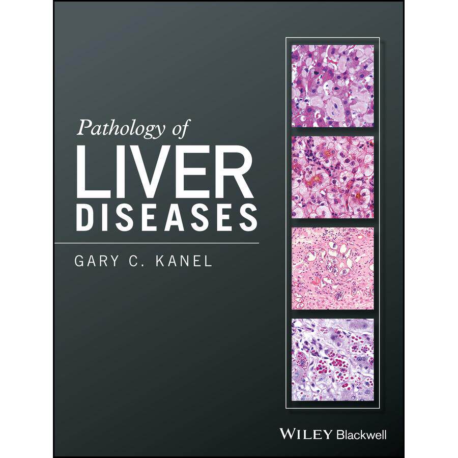 【预售 按需印刷】英文原版肝脏疾病病理学Pathology of Liver Diseases原装进口正版书籍