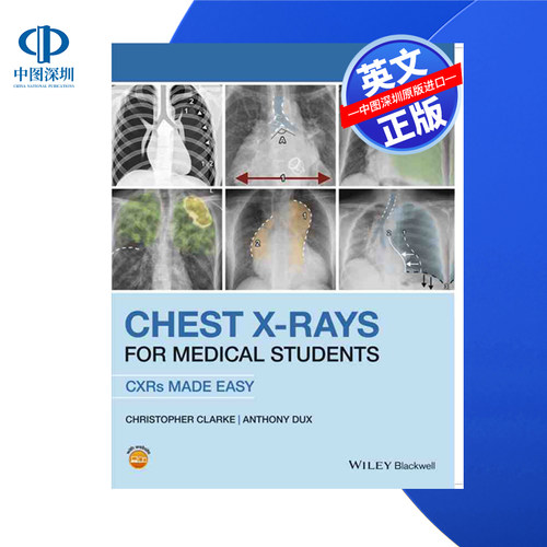 【预售 按需印刷】Wiley出版 医科学生的胸部x光：让x光透视变得容易 Chest X-Rays for Medical Students 进口英文正版书籍