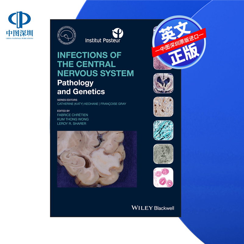 【预售 按需印刷】Wiley出版 中枢神经系统感染：病理学和遗传学 Infections of the Central Nervous System 进口英文正版书籍