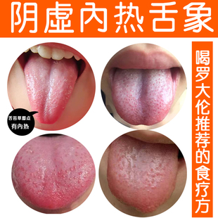 儿童阴虚体质内热 滋阴润燥 心烦肝火旺盛 调理地图 草霉舌清热茶