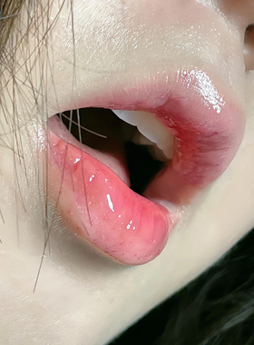 粉~嫩~霜~ 私处粉嫩去黑色素乳晕乳头变粉嫩红大腿屁股腋下褪黑素