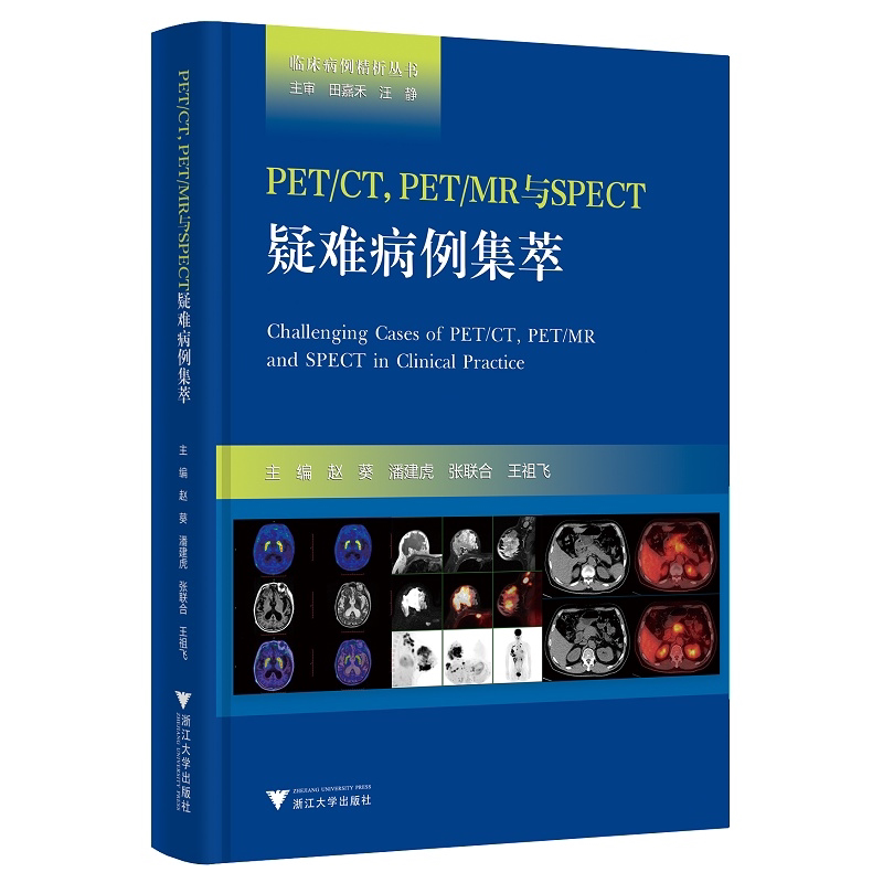 PET/CT,PET/MR与SPECT疑难病例集萃(精)/临床病例精析丛书/赵葵/潘建虎/张联合/王祖飞/浙江大学出版社