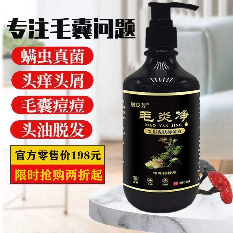 头皮毛炎净洗发水去屑中药去除螨头上长痘痘毛囊严重头屑头痒