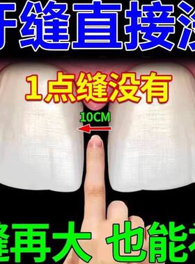 全瓷贴面牙缝宽大修复神器修补贴片遮丑自己贴洞膏树脂遮盖门牙