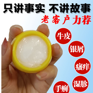 皮肤瘙痒体湿胗止痒乳膏