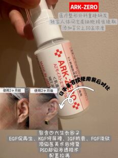 限量发售！日本翳廖专业团队研发ARK-ZERO乳液高浓度干细胞上清液