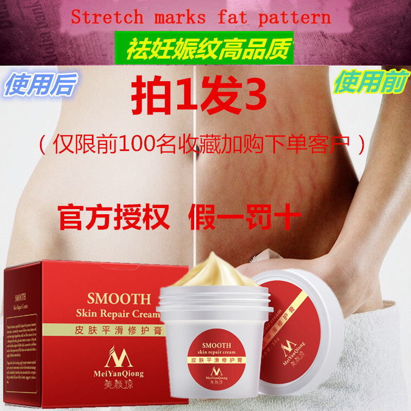 [hzz护肤身体乳,霜]美颜琼高品质皮肤平滑修复膏产前后孕妇月销量0件仅售69元