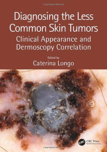 预售 按需印刷 Diagnosing the Less Common Skin Tumors 书籍/杂志/报纸 原版其它 原图主图