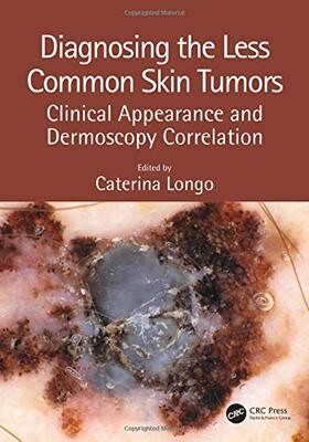 【预售 按需印刷】 Diagnosing the Less Common Skin Tumors